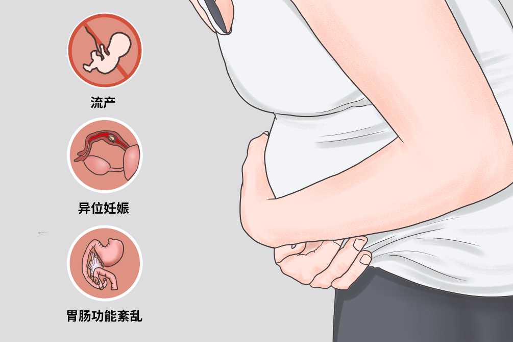 北京助孕专家-50岁北京借卵助孕