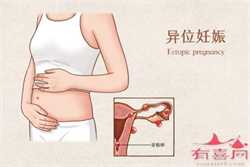 北京代生男孩子，北京美中宜和治疗不孕不育怎么样?