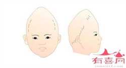 北京代怀生男孩捐卵~北京供卵医院在哪~，怎样缓解顺产后宫缩痛 这几个方法值